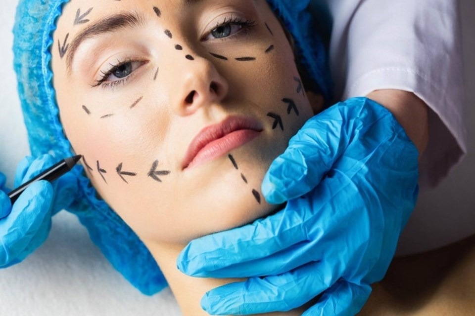 RINOPLASTIA FUNCIONAL 