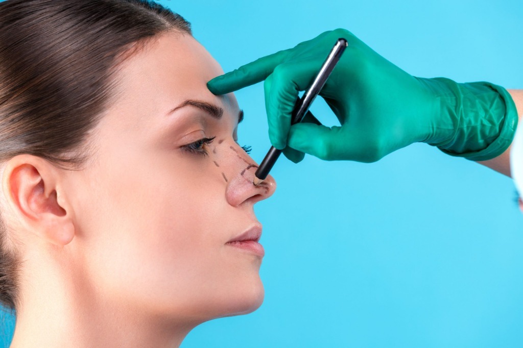 RINOPLASTIA DE REVISIÓN